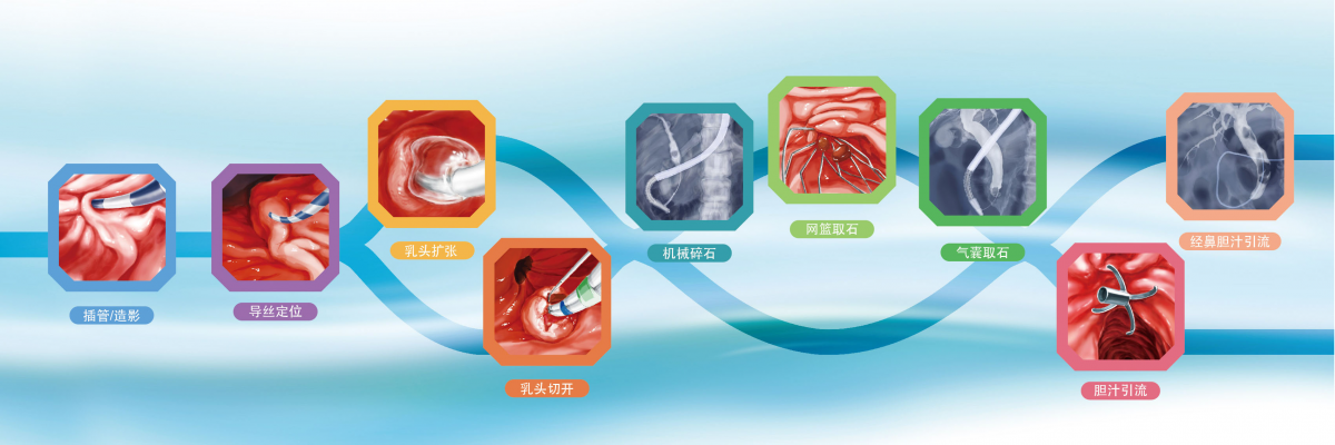 cd33檢測試劑（cd33-percp-cy5.5）