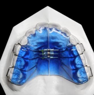 華偉定制式矯治器擴弓型、矯治保持型、牙膠片型