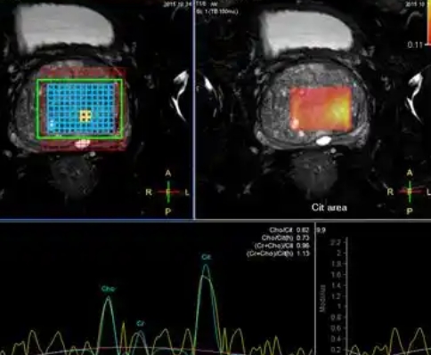前列腺mri醫(yī)學影像存儲傳輸與處理軟件