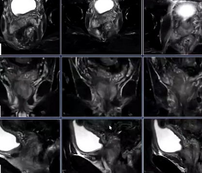 胰腺mri醫(yī)學影像存儲傳輸與處理軟件