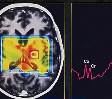 磁共振成像系統(tǒng)mri system